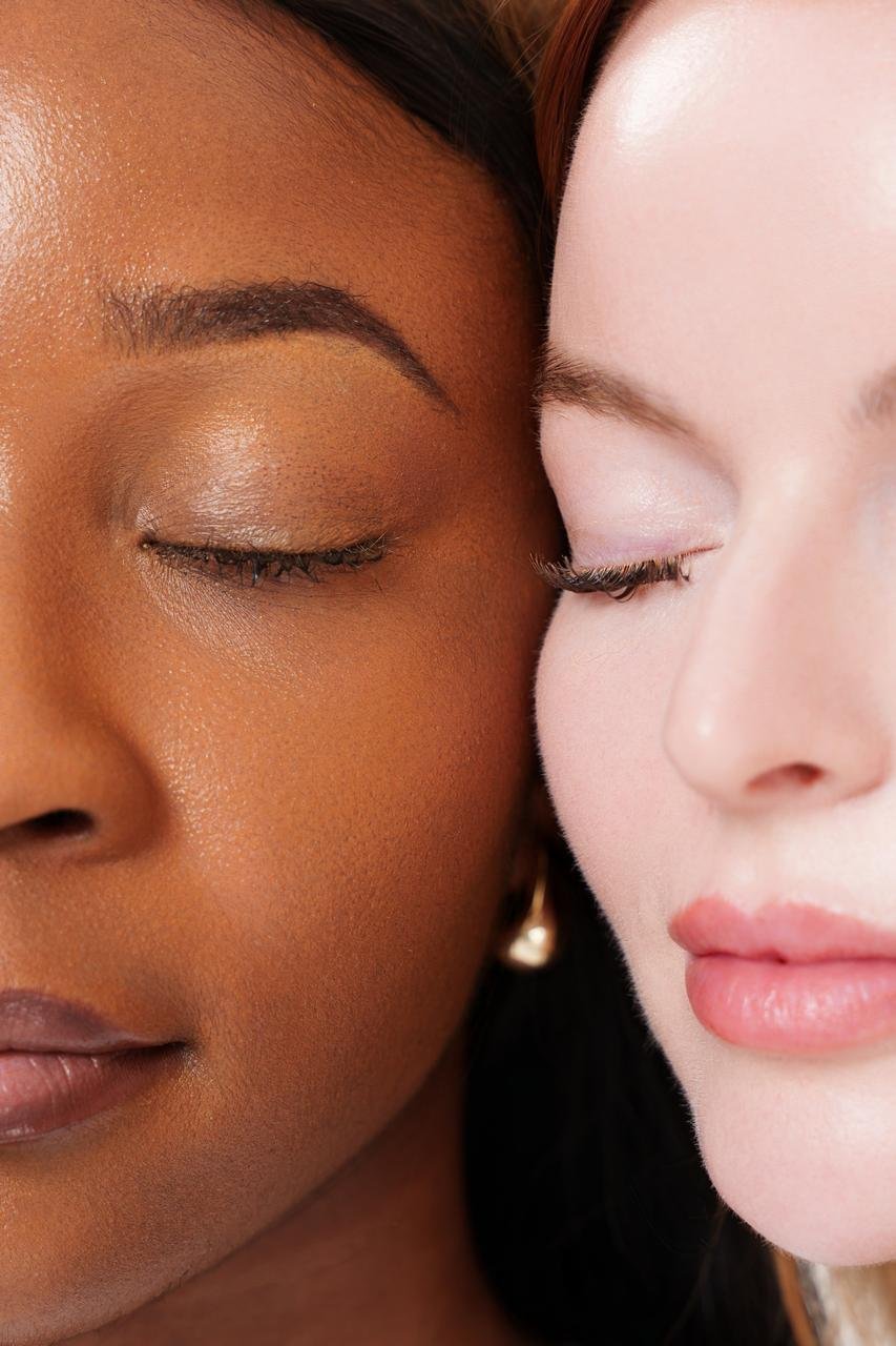 Melasma and pigmentation at EmpaGlow Skin Clinic Calgary